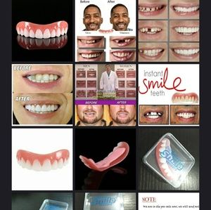 Veneers, Prefect Smile